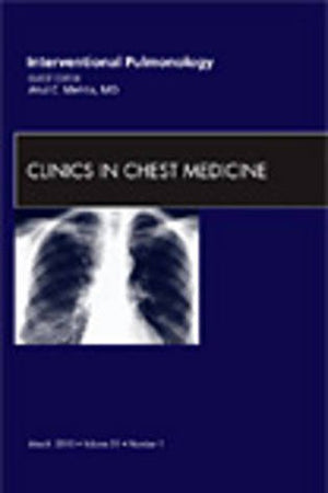 Interventional Pulmonology, An Issue of Clinics in Chest Medicine (Volume 31-1) (The Clinics: Internal Medicine, Volume 31-1)