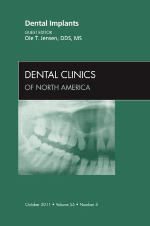 Dental Implants, An Issue of Dental Clinics (Volume 55-4) (The Clinics: Dentistry, Volume 55-4)