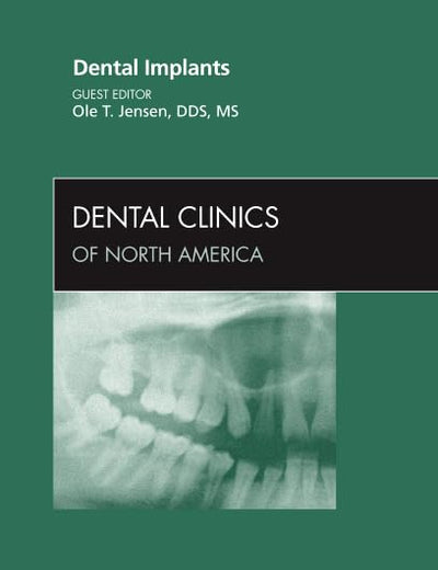 Dental Implants, An Issue of Dental Clinics (Volume 55-4) (The Clinics: Dentistry, Volume 55-4)
