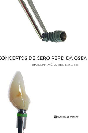 Conceptos de Cero Pérdida Ósea (Spanish Edition)