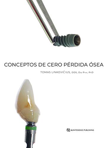 Conceptos de Cero Pérdida Ósea (Spanish Edition)