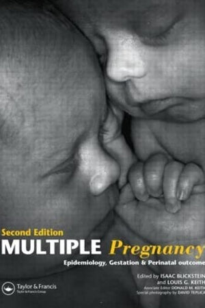 Multiple Pregnancy: Epidemiology, Gestation, and Perinatal Outcome