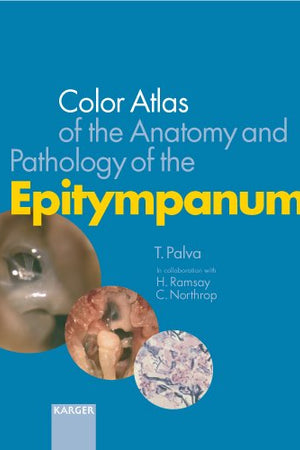 Color Atlas of the Anatomy and Pathology of the Epitympanum
