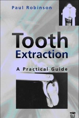 Tooth Extraction: A Practical Guide