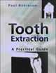 Tooth Extraction: A Practical Guide