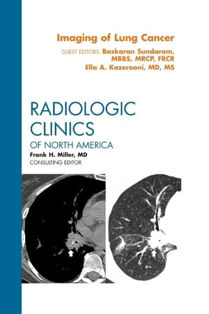 Imaging of Lung Cancer, An Issue of Radiologic Clinics of North America (Volume 50-5) (The Clinics: Radiology, Volume 50-5)