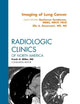 Imaging of Lung Cancer, An Issue of Radiologic Clinics of North America (Volume 50-5) (The Clinics: Radiology, Volume 50-5)