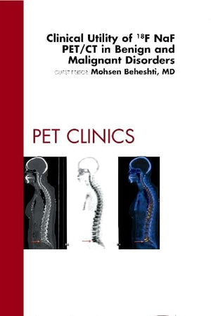 Clinical Utility of 18NaF PET/CT in Benign and Malignant Disorders, An Issue of PET Clinics (Volume 7-3) (The Clinics: Radiology, Volume 7-3)