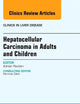 Hepatocellular Carcinoma in Adults and Children, An Issue of Clinics in Liver Disease (Volume 19-2) (The Clinics: Internal Medicine, Volume 19-2)