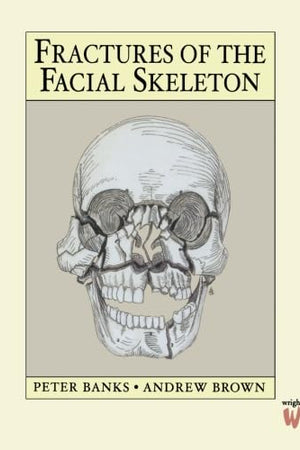 Fractures of the Facial Skeleton