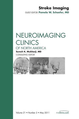 Stroke Imaging, An Issue of Neuroimaging Clinics (Volume 21-2) (The Clinics: Radiology, Volume 21-2)