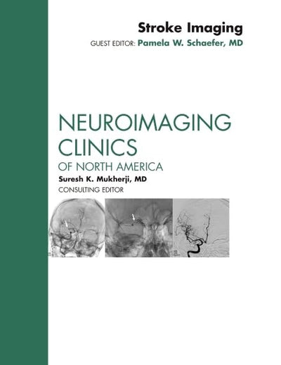 Stroke Imaging, An Issue of Neuroimaging Clinics (Volume 21-2) (The Clinics: Radiology, Volume 21-2)