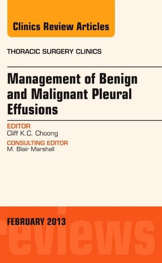 Management of Benign and Malignant Pleural Effusions