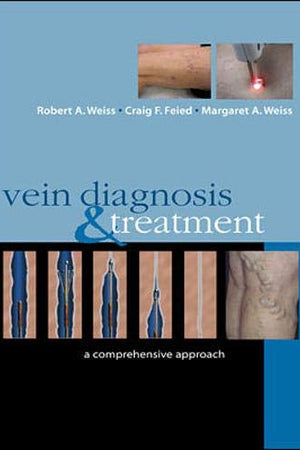 Vein Diagnosis & Treatment: A Comprehensive Approach