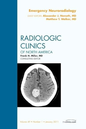 Emergency Neuroradiology, An Issue of Radiologic Clinics of North America (Volume 49-1) (The Clinics: Radiology, Volume 49-1)