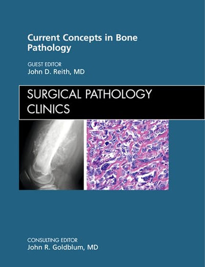 Current Concepts in Bone Pathology, An Issue of Surgical Pathology Clinics (Volume 5-1) (The Clinics: Internal Medicine, Volume 5-1)