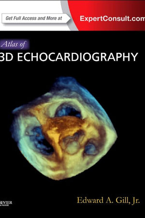 Atlas of 3D Echocardiography: Expert Consult – Online and Print