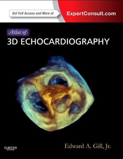 Atlas of 3D Echocardiography: Expert Consult – Online and Print
