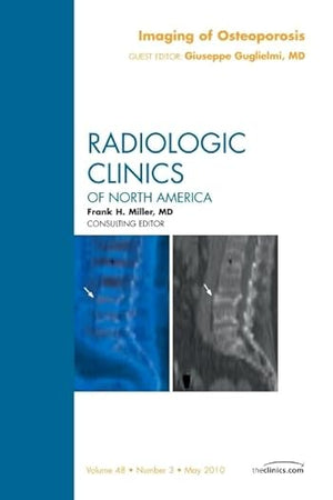 Imaging of Osteoporosis, An Issue of Radiologic Clinics of North America (Volume 48-3) (The Clinics: Radiology, Volume 48-3)