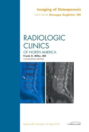 Imaging of Osteoporosis, An Issue of Radiologic Clinics of North America (Volume 48-3) (The Clinics: Radiology, Volume 48-3)