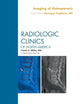 Imaging of Osteoporosis, An Issue of Radiologic Clinics of North America (Volume 48-3) (The Clinics: Radiology, Volume 48-3)
