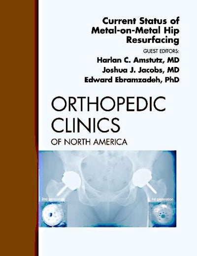 Current Status of Metal-on-Metal Hip Resurfacing, An Issue of Orthopedic Clinics (Volume 42-2) (The Clinics: Orthopedics, Volume 42-2)