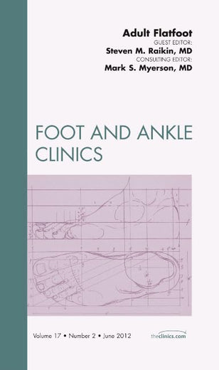Adult Flatfoot, An Issue of Foot and Ankle Clinics (Volume 17-2) (The Clinics: Orthopedics, Volume 17-2)