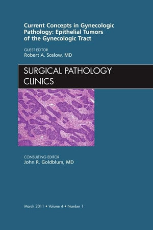 Current Concepts in Gynecologic Pathology: Epithelial Tumors of the Gynecologic Tract, An Issue of Surgical Pathology Clinics (Volume 4-1) (The Clinics: Internal Medicine, Volume 4-1)