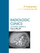 CT Angiography, An Issue of Radiologic Clinics of North America (Volume 48-2) (The Clinics: Radiology, Volume 48-2)