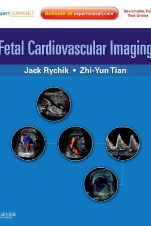 Fetal Cardiovascular Imaging: A Disease Based Approach: Expert Consult Premium Edition: Enhanced Online Features and Print