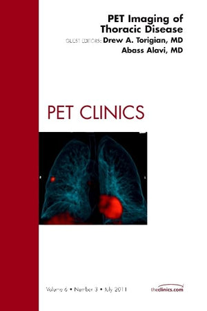 PET Imaging of Thoracic Disease, An Issue of PET Clinics (Volume 6-3) (The Clinics: Radiology, Volume 6-3)