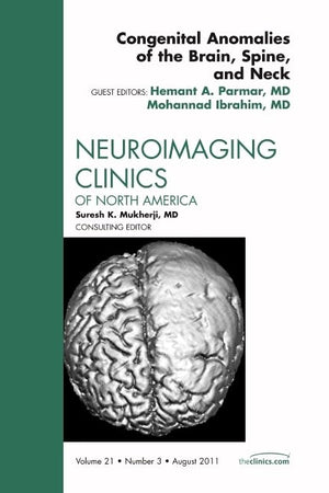 Congenital Anomalies of the Brain, Spine, and Neck, An Issue of Neuroimaging Clinics (Volume 21-3) (The Clinics: Radiology, Volume 21-3)