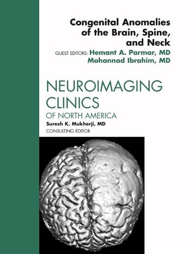Congenital Anomalies of the Brain, Spine, and Neck, An Issue of Neuroimaging Clinics (Volume 21-3) (The Clinics: Radiology, Volume 21-3)