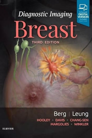 Diagnostic Imaging: Breast