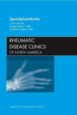 Spondyloarthropathies, An Issue of Rheumatic Disease Clinics (Volume 38-3) (The Clinics: Internal Medicine, Volume 38-3)