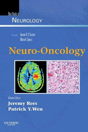 Neuro-Oncology