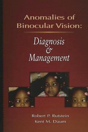 Anomalies Of Binocular Vision: Diagnosis And Management