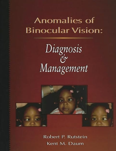 Anomalies Of Binocular Vision: Diagnosis And Management