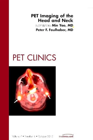 PET Imaging of the Head and Neck, An Issue of PET Clinics (Volume 7-4) (The Clinics: Radiology, Volume 7-4)