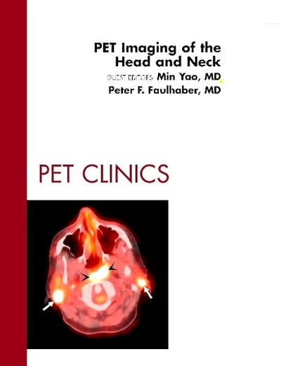 PET Imaging of the Head and Neck, An Issue of PET Clinics (Volume 7-4) (The Clinics: Radiology, Volume 7-4)