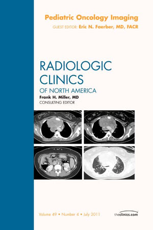 Pediatric Oncology Imaging, An Issue of Radiologic Clinics of North America (Volume 49-4) (The Clinics: Radiology, Volume 49-4)