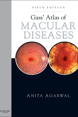 Gass' Atlas of Macular Diseases: 2-Volume Set - Expert Consult: Online and Print