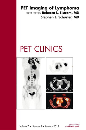 PET Imaging of Lymphoma, An Issue of PET Clinics (Volume 7-1) (The Clinics: Radiology, Volume 7-1)