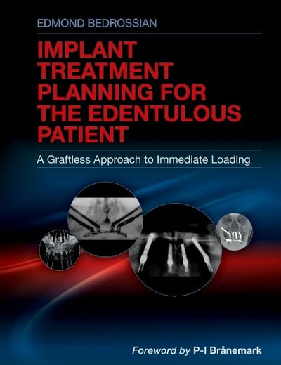Implant Treatment Planning for the Edentulous Patient: A Graftless Approach to Immediate Loading