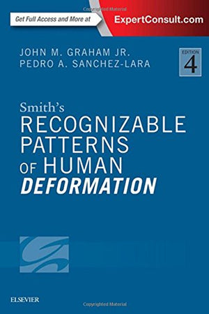 Smith's Recognizable Patterns of Human Deformation
