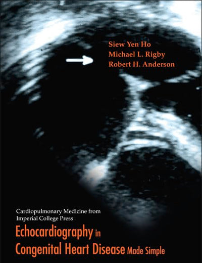 ECHOCARDIOGRAPHY IN CONGENITAL HEART DISEASE MADE SIMPLE (Cardiopulmonary Medicine from Imperial College Press)