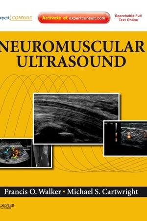 Neuromuscular Ultrasound: Expert Consult - Online and Print