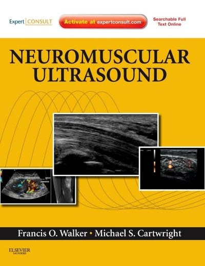 Neuromuscular Ultrasound: Expert Consult - Online and Print