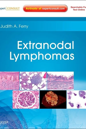 Extranodal Lymphomas: Expert Consult - Online and Print