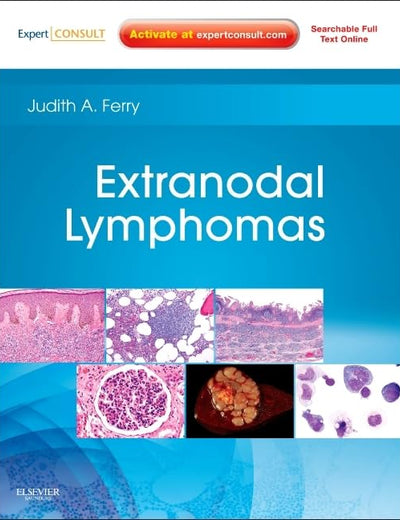 Extranodal Lymphomas: Expert Consult - Online and Print